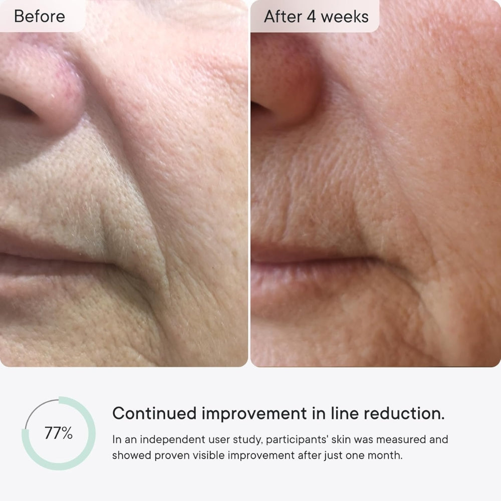 Selvine™ – Micro-Infusion Anti-Wrinkle Patches