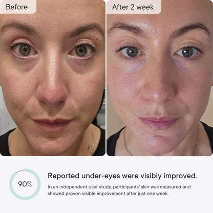 Selvine™ – Micro-Infusion Anti-Wrinkle Patches